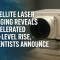 Satellite Laser Ranging Technique Reveals Accelerated Sea-Level Rise